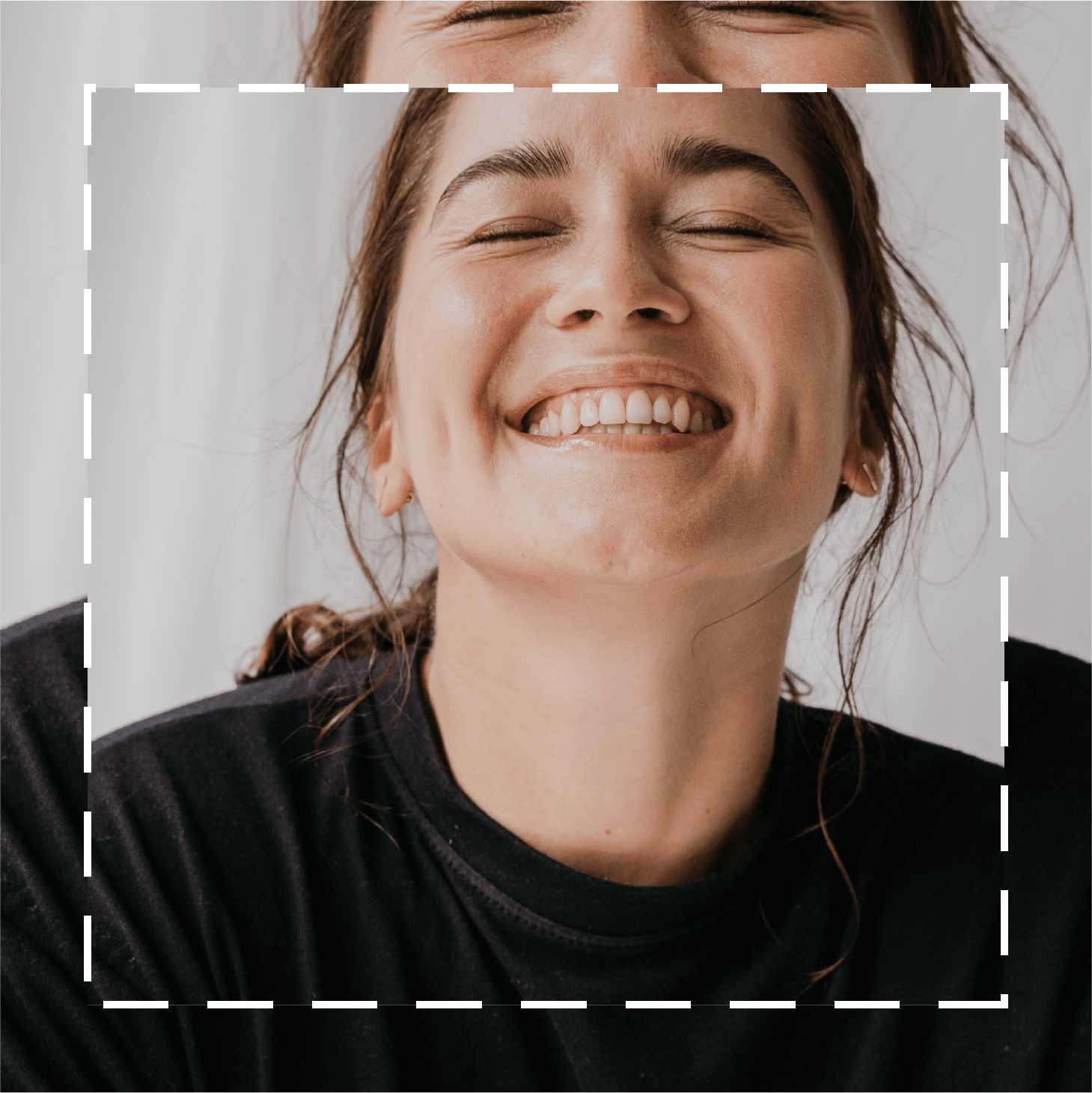 The Best Treatments for Different Types of Wrinkles