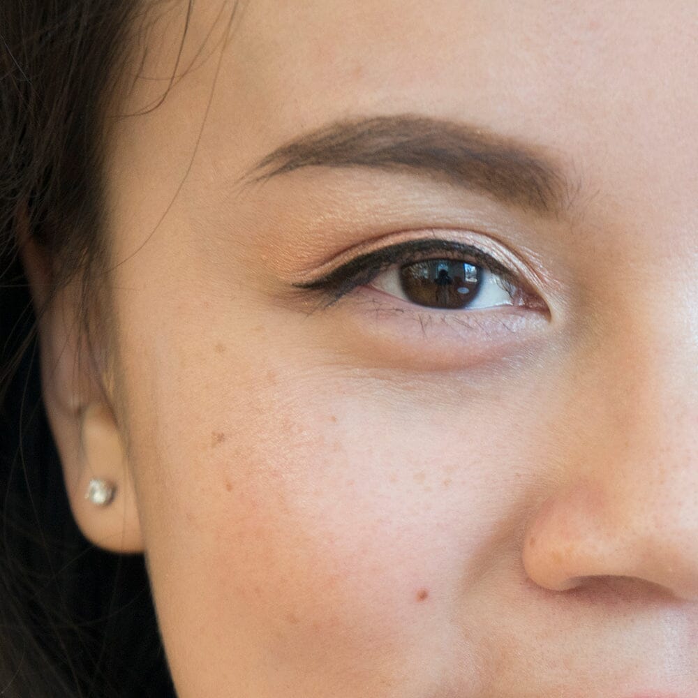 Your Complete Guide on The Causes of Dark Circles, and How to Treat Them