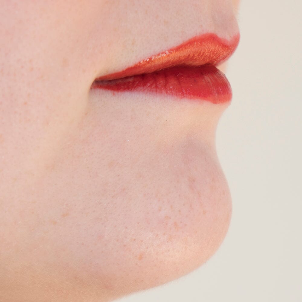 When Should You Apply an Acne Treatment In Your Routine?