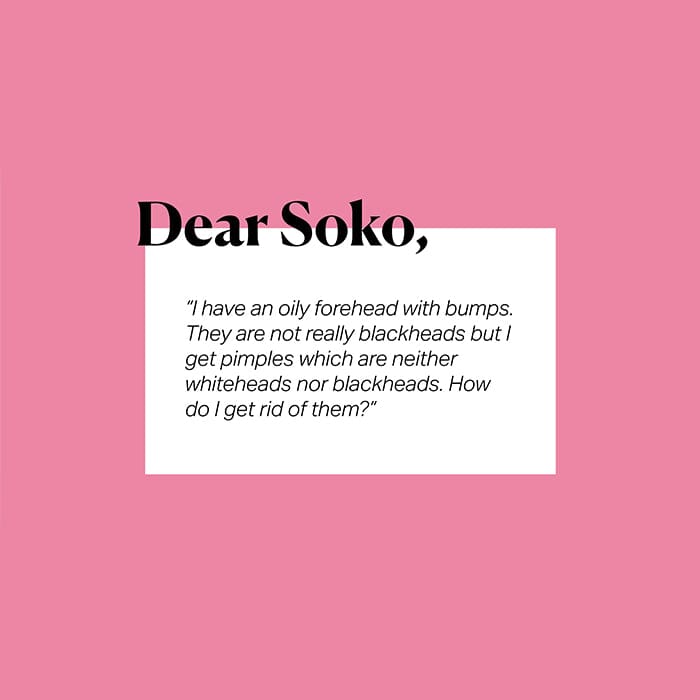 Dear Soko: How Can I Get Rid of Forehead Bumps?