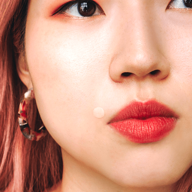The Best Spot Treatments for Different Types of Acne