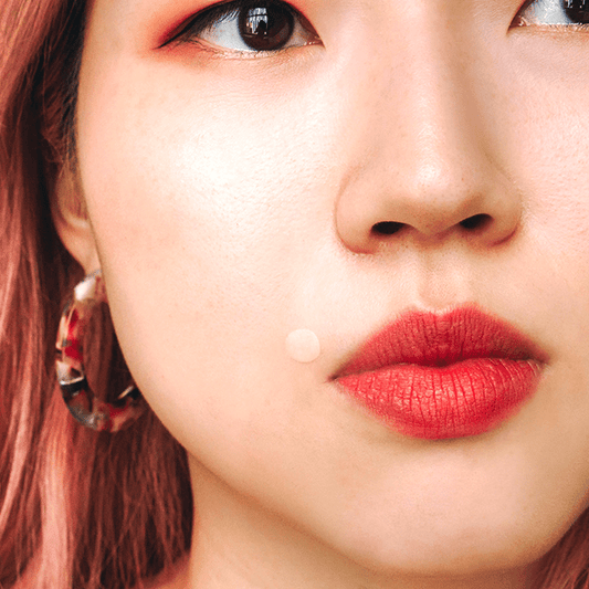 The Best Spot Treatments for Different Types of Acne