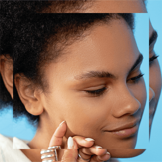 Do You Really Need…Products Specifically Made for Adult Acne?