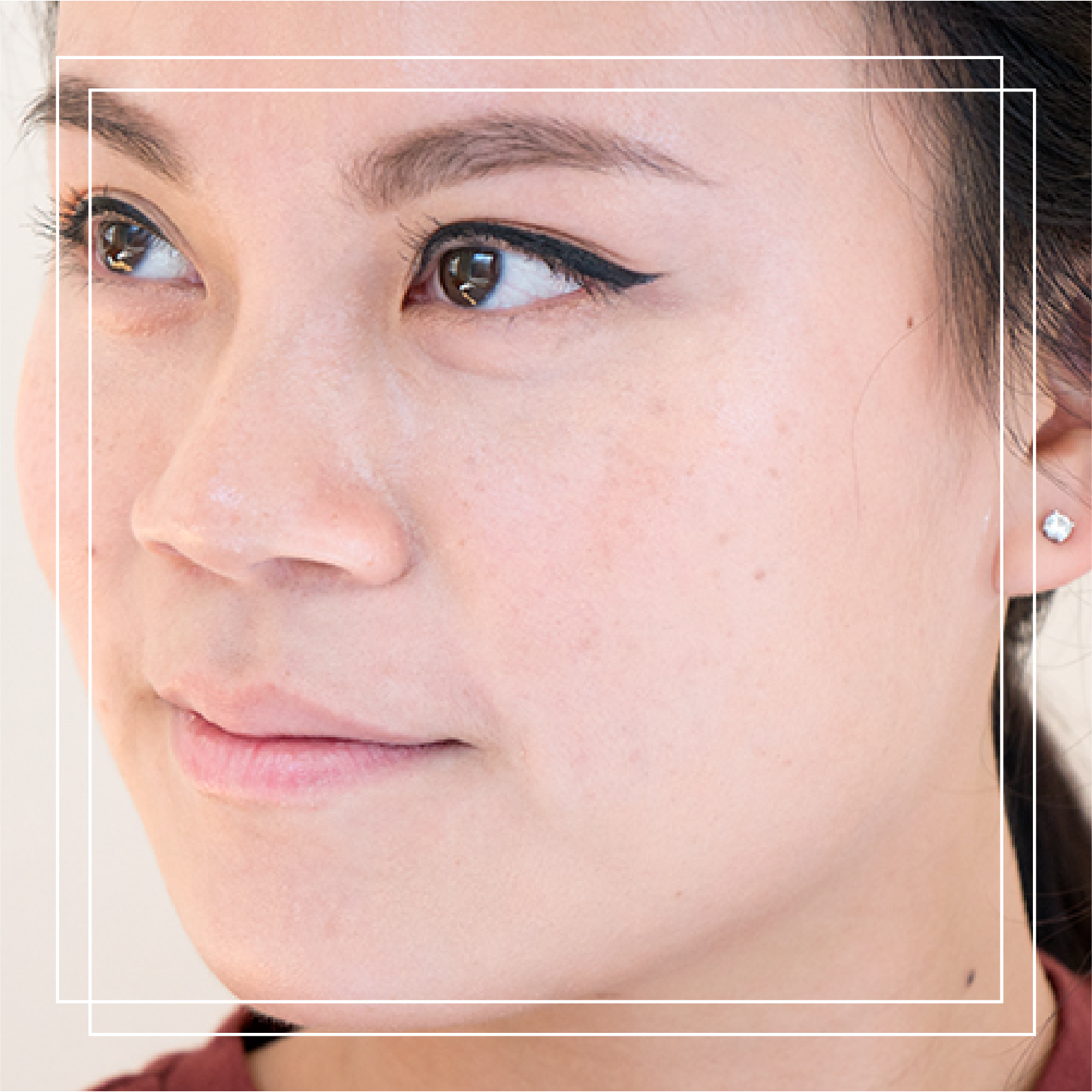 Why Your Pores Are Enlarged and What You Can do About it