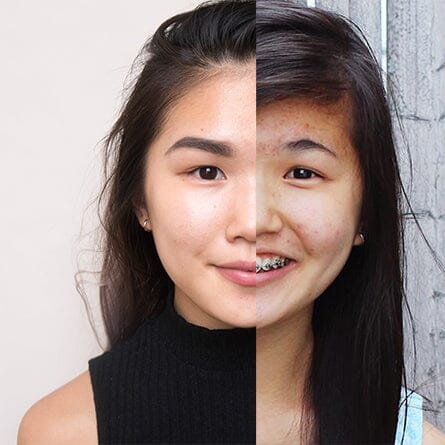 Why I Swore Off American Drugstore Acne Products and Switched to K-beauty