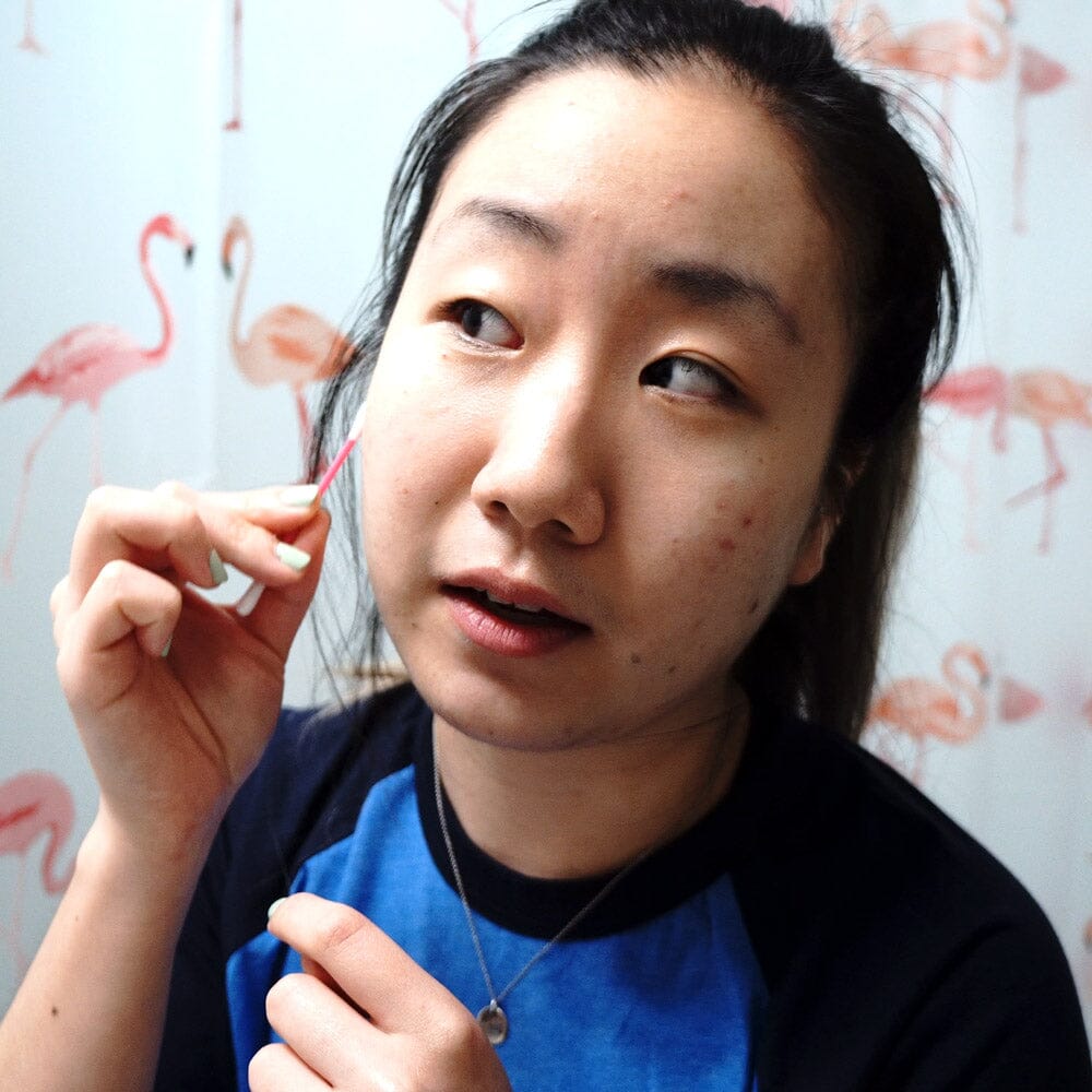 The Acne Products That Keep My Breakouts Under Control