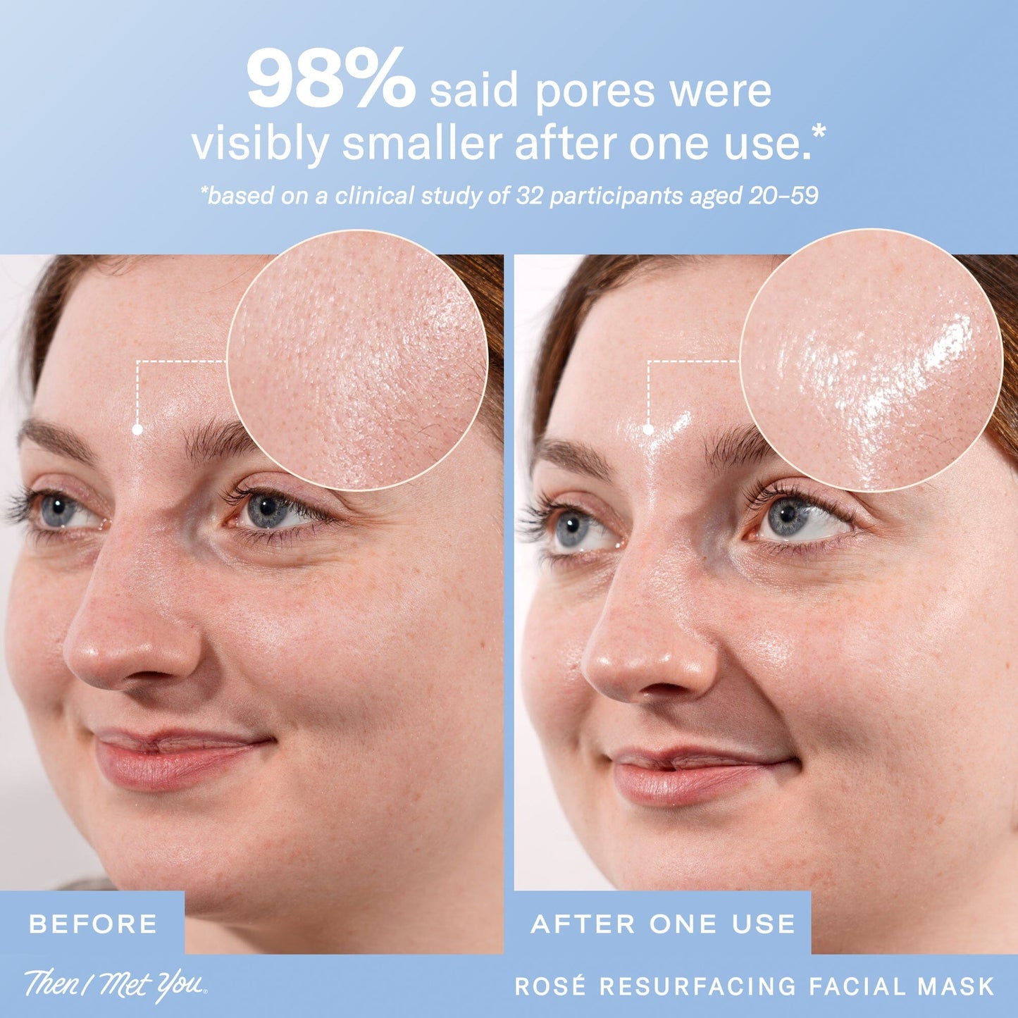 Rosé Resurfacing Facial Mask Wash Off Masks Then I Met You 