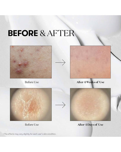 VT Reedle Shot 300 Serum/Ampoule VT COSMETICS 