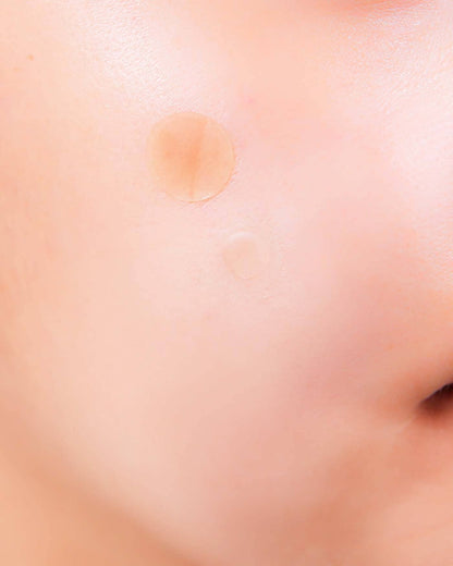 A-Clear Soothing Clear Spot Patch Spot NEOGEN 