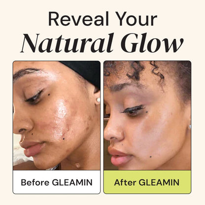 Superactive Serum Serum/Ampoule Gleamin 