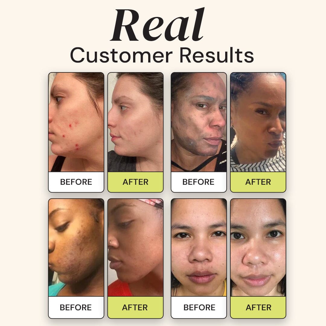 Superactive Serum Serum/Ampoule Gleamin 