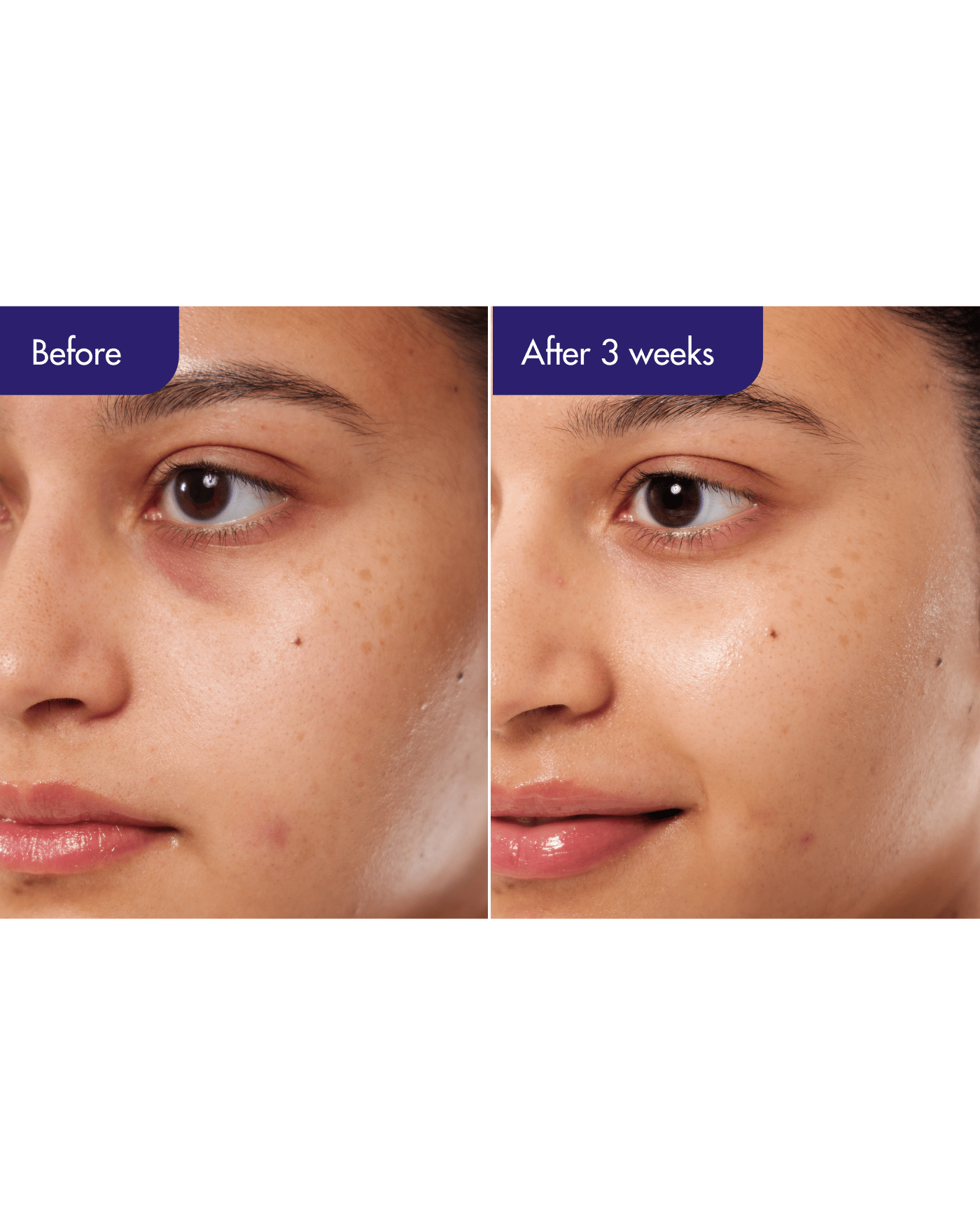 PDRN Caffeine Shot Serum Serum/Ampoule IOPE 