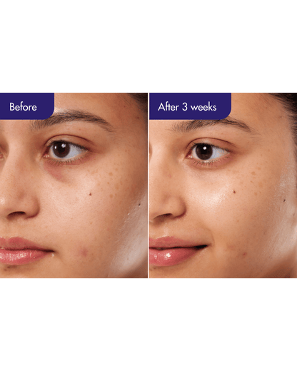 PDRN Caffeine Shot Serum Serum/Ampoule IOPE 