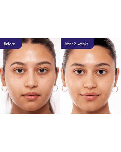 PDRN Caffeine Shot Serum Serum/Ampoule IOPE 