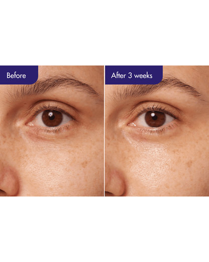 Retinol Expert 0.1% Serum/Ampoule IOPE 