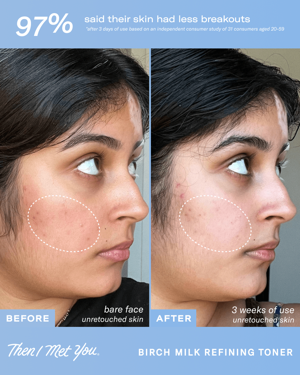 Birch Milk Refining Toner