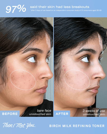 Birch Milk Refining Toner Toner Then I Met You 