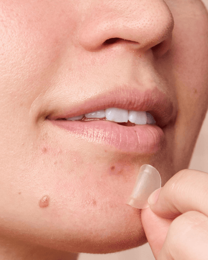 Might Patch - Micropoint for Blemishes Treatment/Balm Hero Cosmetics 