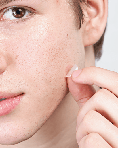 Micropoint for Blemishes, 8ct Hero Cosmetics 