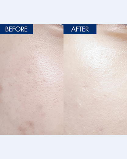 YULMU Brightening Spot Cream Facial Moisturizer INWARD 