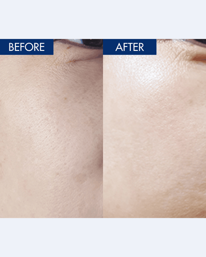 YULMU Brightening Spot Cream Facial Moisturizer INWARD 