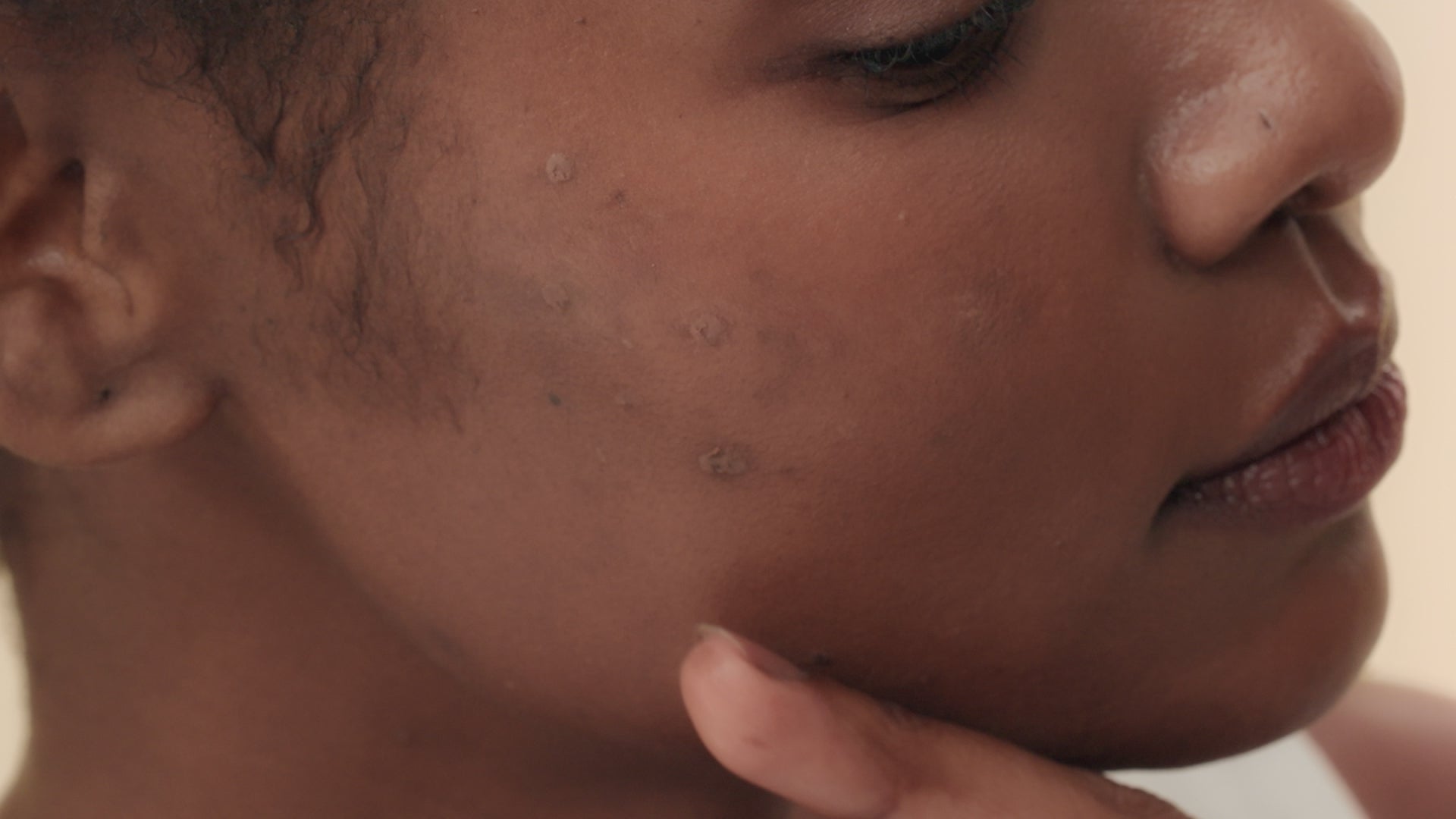 Alpha-Arbutin 2 Discoloration Care Serum