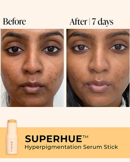 Superhue Color Live Tinted 