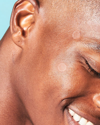 the klog Soft Shield Pimple Patch 